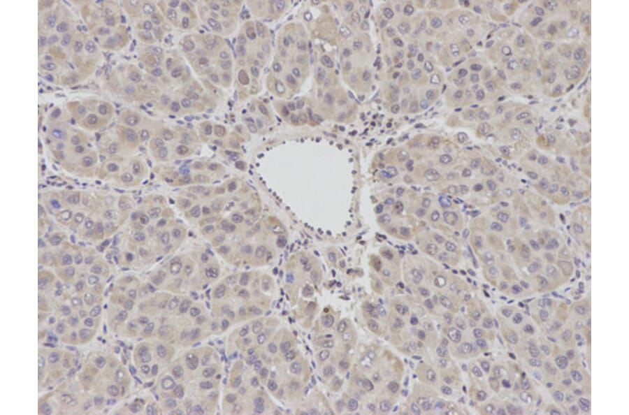 Immunohistochemistry - BCL2 Antibody from Signalway Antibody (32012) - Antibodies.com