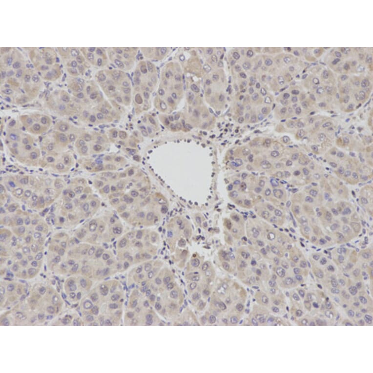 Immunohistochemistry - BCL2 Antibody from Signalway Antibody (32012) - Antibodies.com