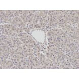 Immunohistochemistry - BCL2 Antibody from Signalway Antibody (32012) - Antibodies.com