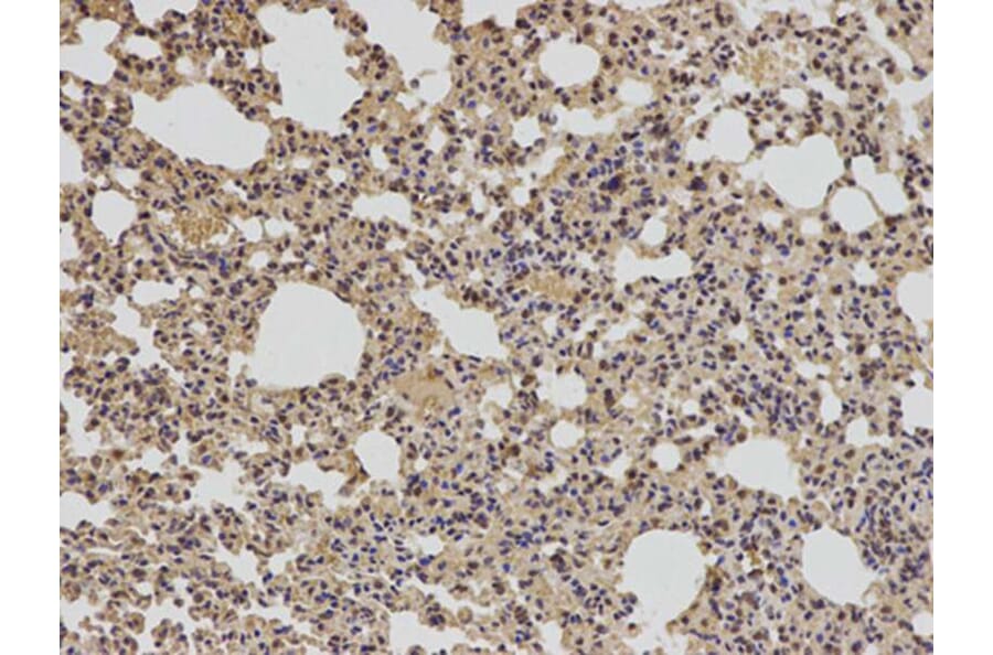 Immunohistochemistry - BCL2 Antibody from Signalway Antibody (32012) - Antibodies.com