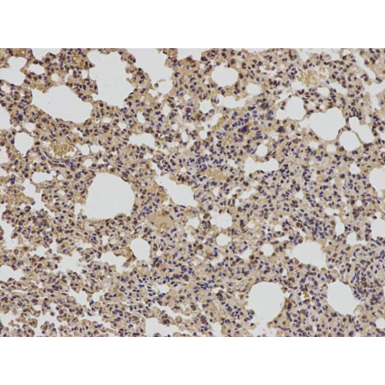 Immunohistochemistry - BCL2 Antibody from Signalway Antibody (32012) - Antibodies.com