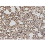 Immunohistochemistry - BCL2 Antibody from Signalway Antibody (32012) - Antibodies.com