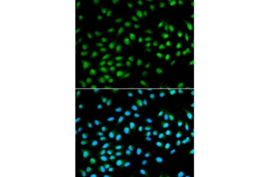 Immunofluorescence - BCL2 Antibody from Signalway Antibody (32012) - Antibodies.com