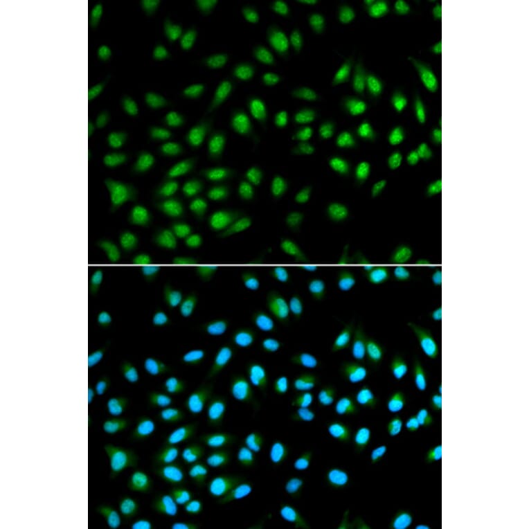 Immunofluorescence - BCL2 Antibody from Signalway Antibody (32012) - Antibodies.com