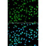 Immunofluorescence - BCL2 Antibody from Signalway Antibody (32012) - Antibodies.com