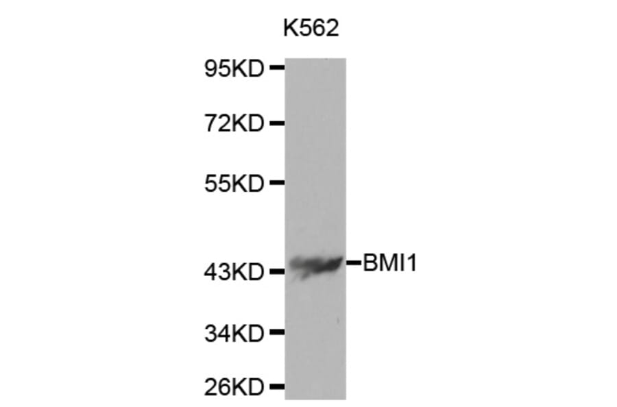 Western blot - BMI1 Antibody from Signalway Antibody (32015) - Antibodies.com