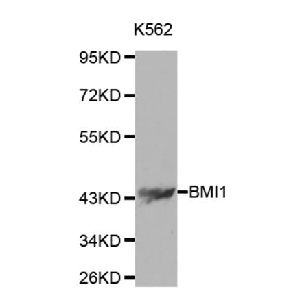 Western blot - BMI1 Antibody from Signalway Antibody (32015) - Antibodies.com