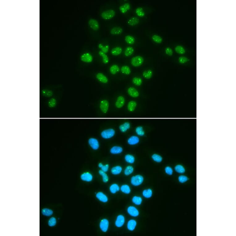Immunofluorescence - BMI1 Antibody from Signalway Antibody (32015) - Antibodies.com