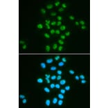 Immunofluorescence - BMI1 Antibody from Signalway Antibody (32015) - Antibodies.com
