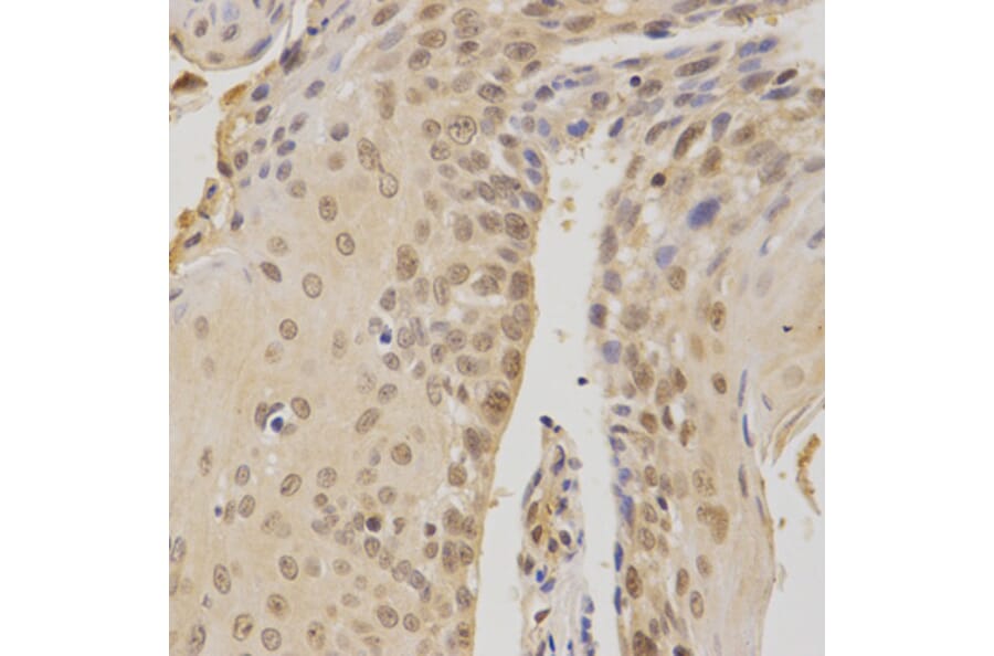 Immunohistochemistry - BMI1 Antibody from Signalway Antibody (32015) - Antibodies.com