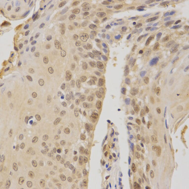 Immunohistochemistry - BMI1 Antibody from Signalway Antibody (32015) - Antibodies.com