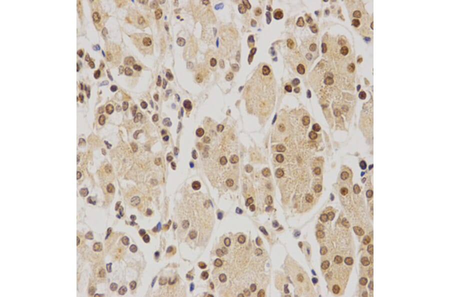 Immunohistochemistry - BMI1 Antibody from Signalway Antibody (32015) - Antibodies.com