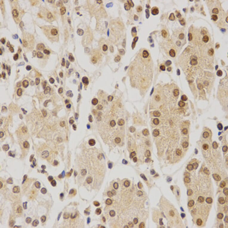 Immunohistochemistry - BMI1 Antibody from Signalway Antibody (32015) - Antibodies.com