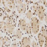 Immunohistochemistry - BMI1 Antibody from Signalway Antibody (32015) - Antibodies.com