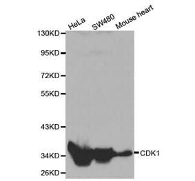 Western blot - CDK1 Antibody from Signalway Antibody (32020) - Antibodies.com