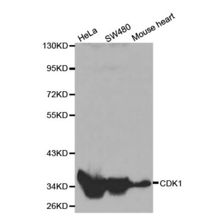 Western blot - CDK1 Antibody from Signalway Antibody (32020) - Antibodies.com