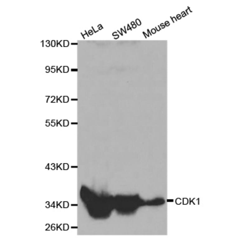 Western blot - CDK1 Antibody from Signalway Antibody (32020) - Antibodies.com