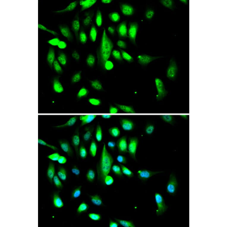 Immunofluorescence - CDK1 Antibody from Signalway Antibody (32020) - Antibodies.com