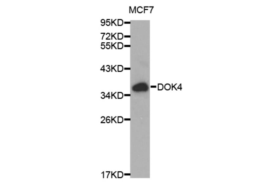 Western blot - DOK4 Antibody from Signalway Antibody (32025) - Antibodies.com