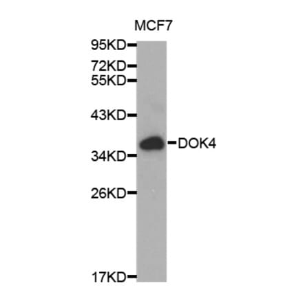 Western blot - DOK4 Antibody from Signalway Antibody (32025) - Antibodies.com