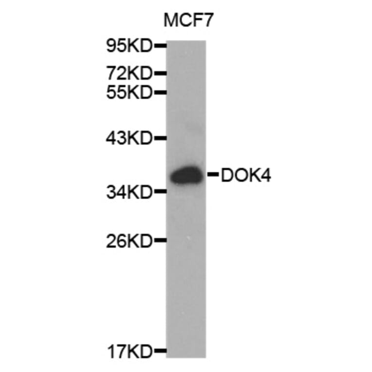 Western blot - DOK4 Antibody from Signalway Antibody (32025) - Antibodies.com