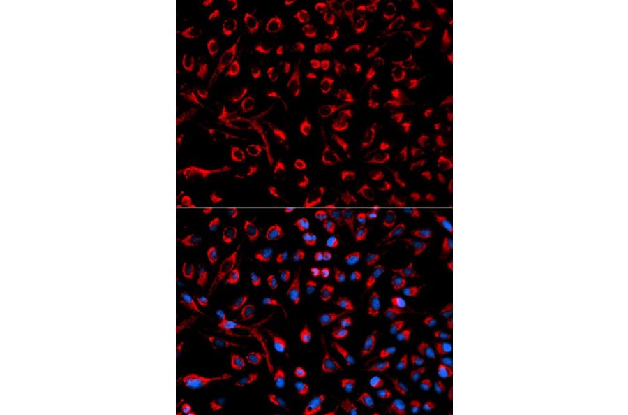 Immunofluorescence - DOK4 Antibody from Signalway Antibody (32025) - Antibodies.com