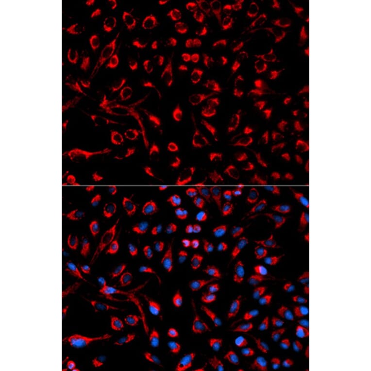 Immunofluorescence - DOK4 Antibody from Signalway Antibody (32025) - Antibodies.com