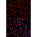 Immunofluorescence - DOK4 Antibody from Signalway Antibody (32025) - Antibodies.com