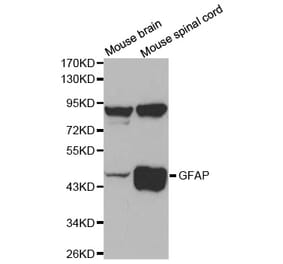 Western blot - GFAP Antibody from Signalway Antibody (32033) - Antibodies.com