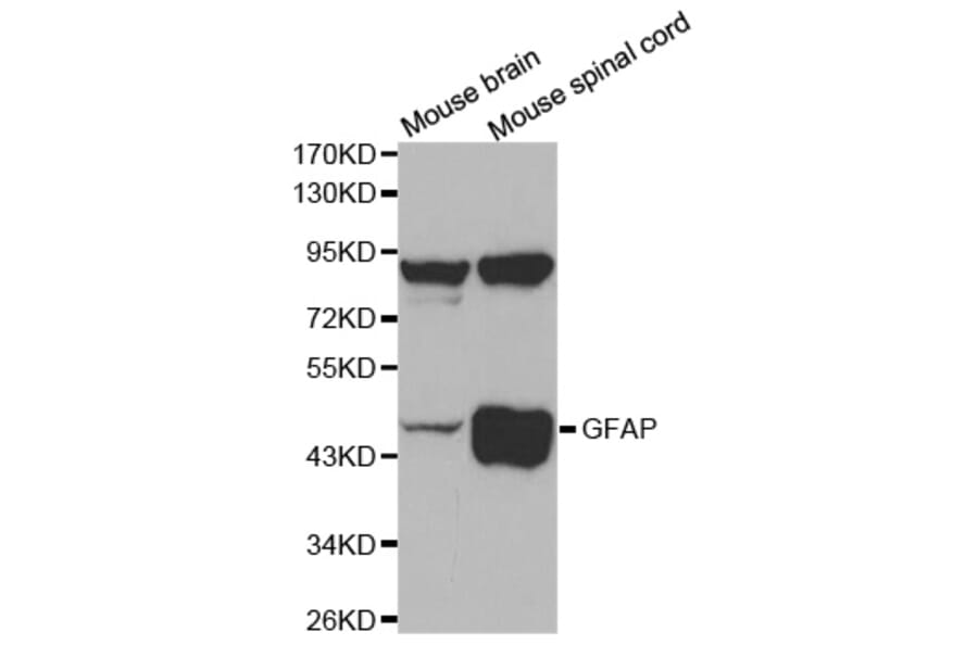 Western blot - GFAP Antibody from Signalway Antibody (32033) - Antibodies.com