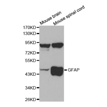 Western blot - GFAP Antibody from Signalway Antibody (32033) - Antibodies.com