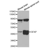 Western blot - GFAP Antibody from Signalway Antibody (32033) - Antibodies.com