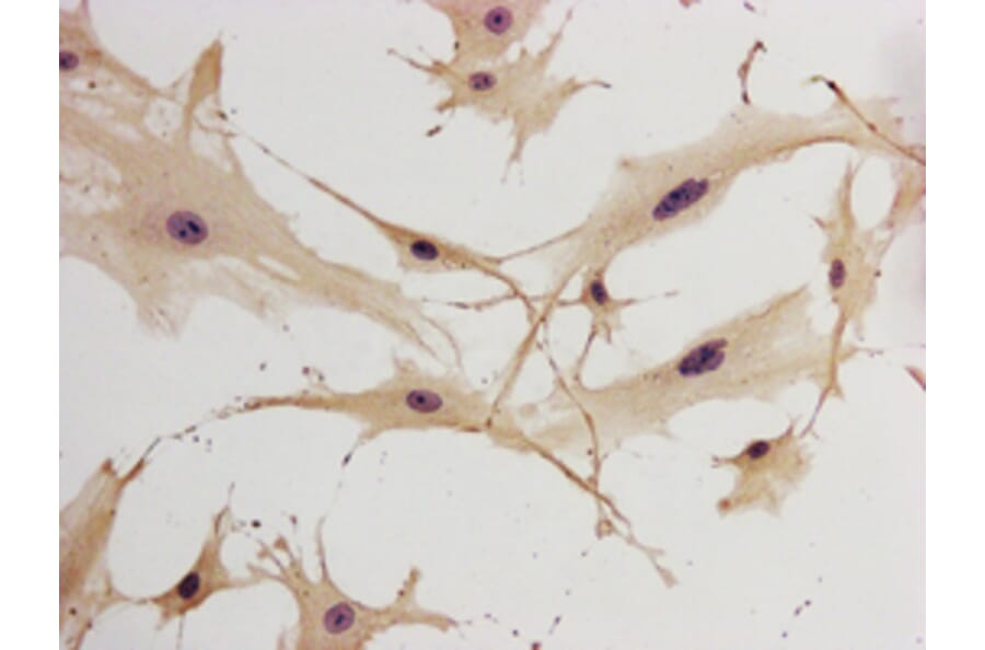 Immunohistochemistry - GFAP Antibody from Signalway Antibody (32033) - Antibodies.com