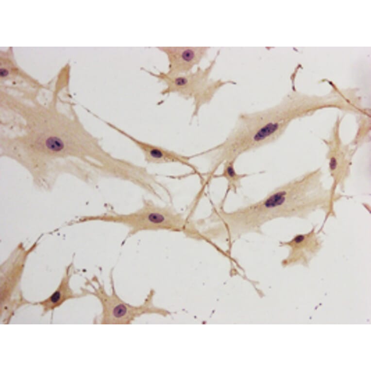 Immunohistochemistry - GFAP Antibody from Signalway Antibody (32033) - Antibodies.com
