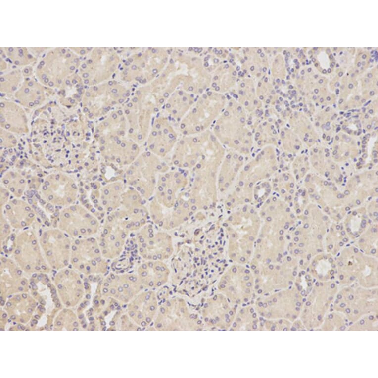 Immunohistochemistry - GFAP Antibody from Signalway Antibody (32033) - Antibodies.com