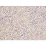 Immunohistochemistry - GFAP Antibody from Signalway Antibody (32033) - Antibodies.com