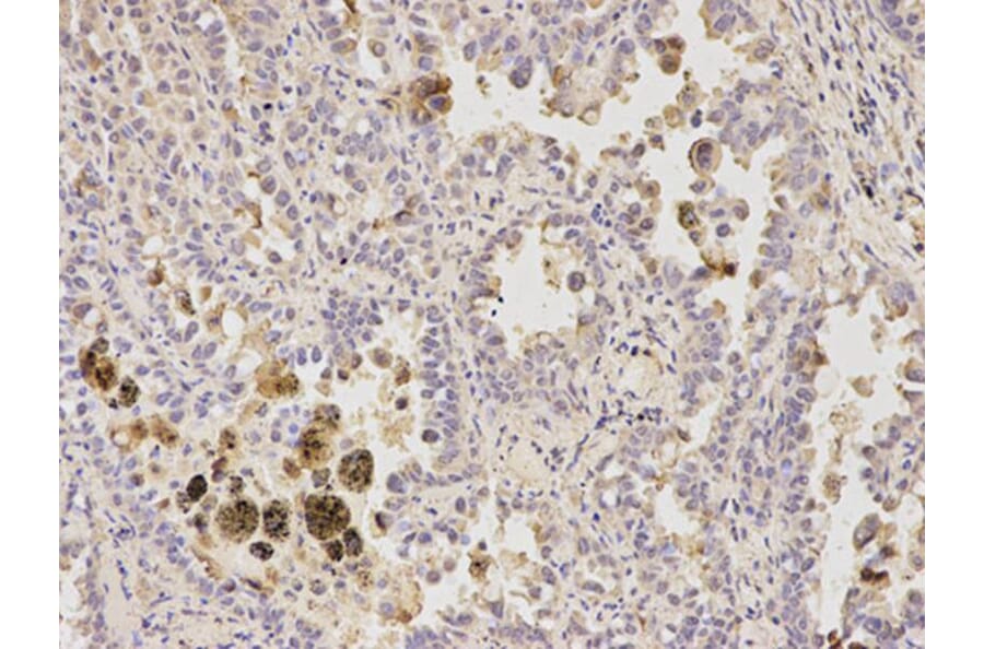 Immunohistochemistry - GFAP Antibody from Signalway Antibody (32033) - Antibodies.com