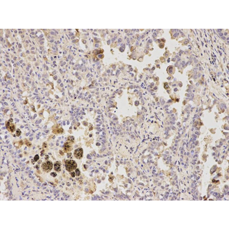 Immunohistochemistry - GFAP Antibody from Signalway Antibody (32033) - Antibodies.com