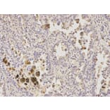 Immunohistochemistry - GFAP Antibody from Signalway Antibody (32033) - Antibodies.com