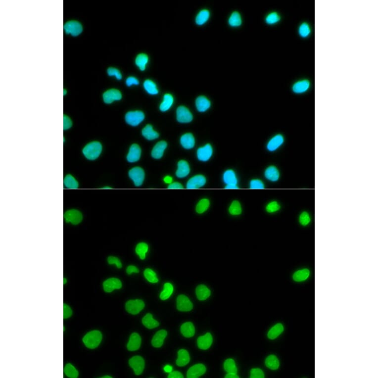 Immunofluorescence - LMNA Antibody from Signalway Antibody (32042) - Antibodies.com
