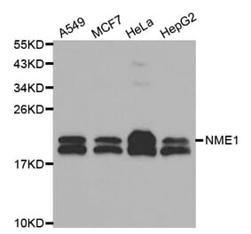 Western blot - NME1 Antibody from Signalway Antibody (32049) - Antibodies.com