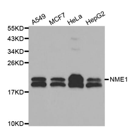 Western blot - NME1 Antibody from Signalway Antibody (32049) - Antibodies.com