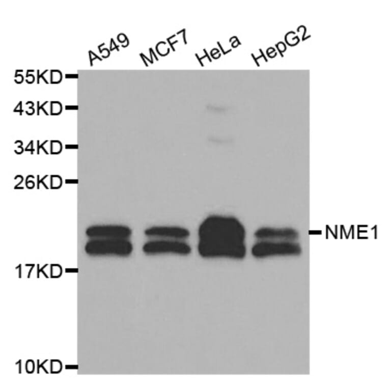 Western blot - NME1 Antibody from Signalway Antibody (32049) - Antibodies.com