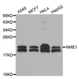 Western blot - NME1 Antibody from Signalway Antibody (32049) - Antibodies.com