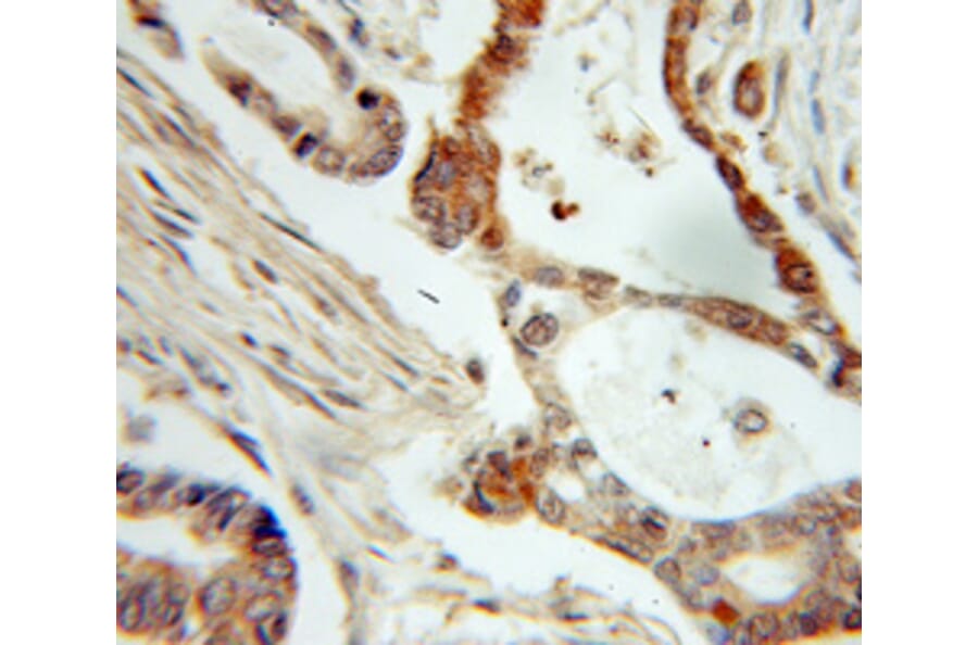 Immunohistochemistry - NME1 Antibody from Signalway Antibody (32049) - Antibodies.com