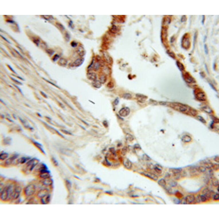Immunohistochemistry - NME1 Antibody from Signalway Antibody (32049) - Antibodies.com