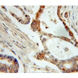 Immunohistochemistry - NME1 Antibody from Signalway Antibody (32049) - Antibodies.com