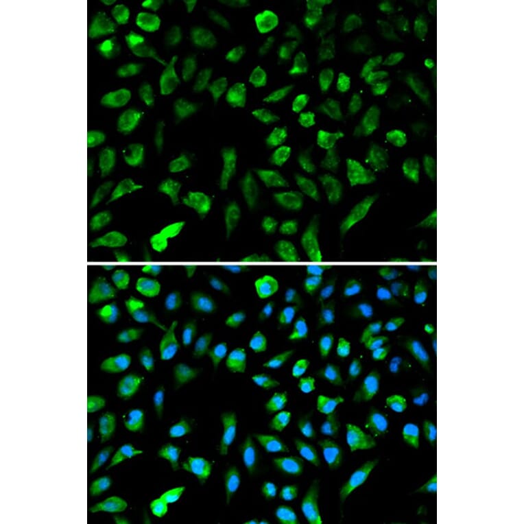 Immunofluorescence - NME1 Antibody from Signalway Antibody (32049) - Antibodies.com