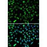 Immunofluorescence - NME1 Antibody from Signalway Antibody (32049) - Antibodies.com