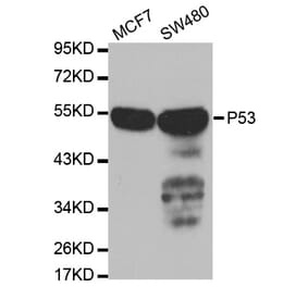 Western blot - TP53 Antibody from Signalway Antibody (32051) - Antibodies.com